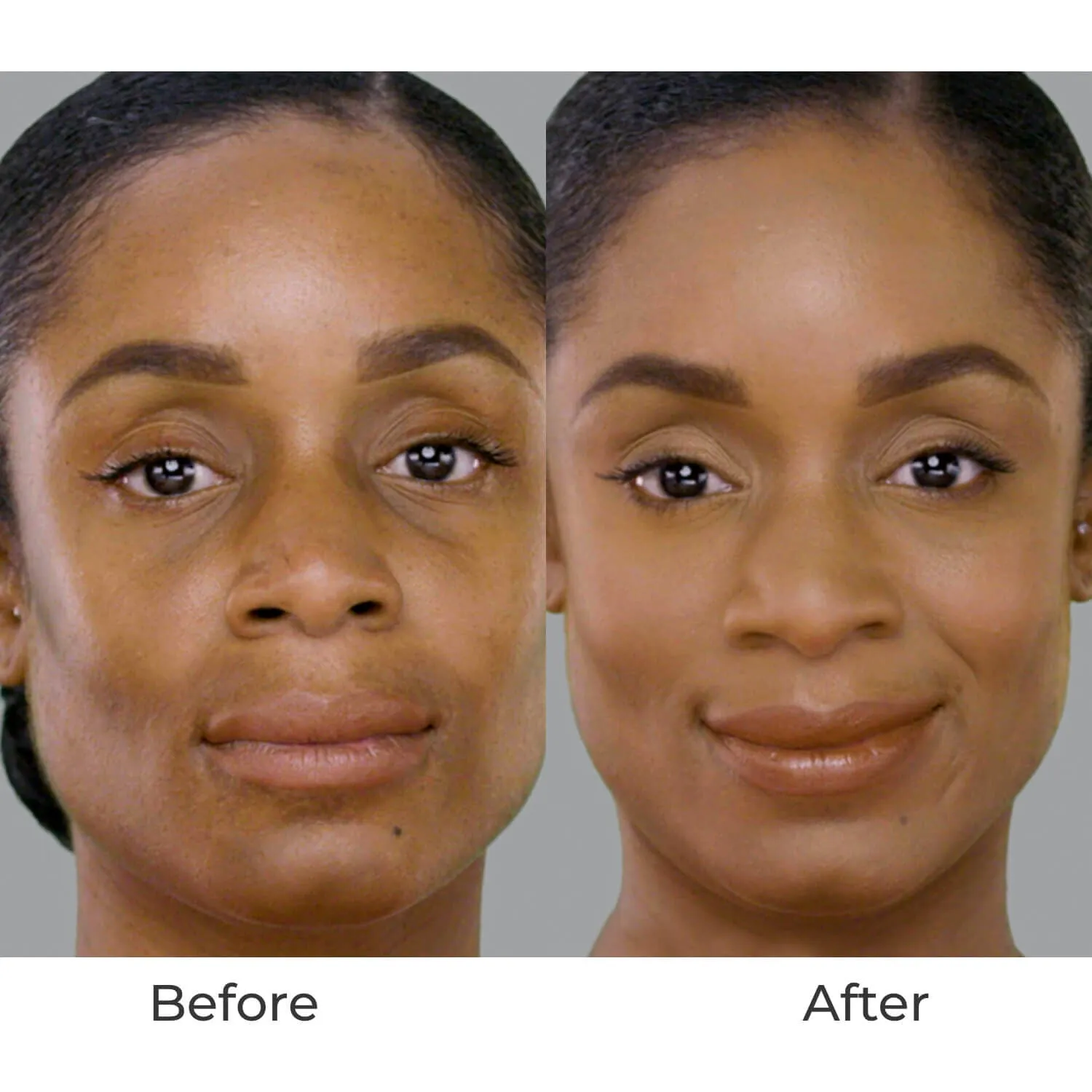 Super-Sized Starter Kit Silk 4-in-1 Advanced